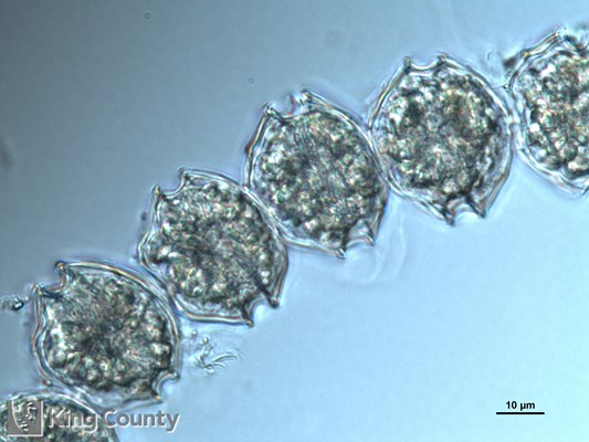 Photo of Alexandrium catenella